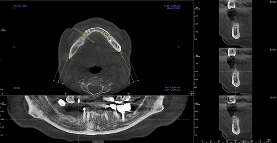 디지털 장비로 안정적인 진단과 수술