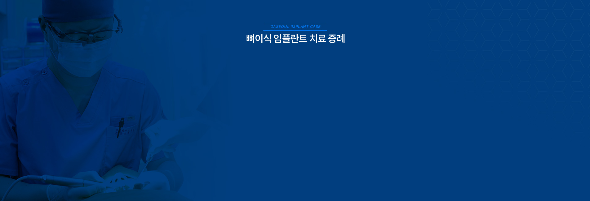 뼈이식 임플란트 치료증례