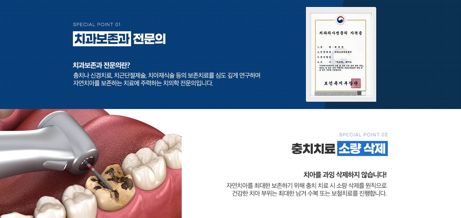 치과보존과 전문의, 충치치료 소량 삭제