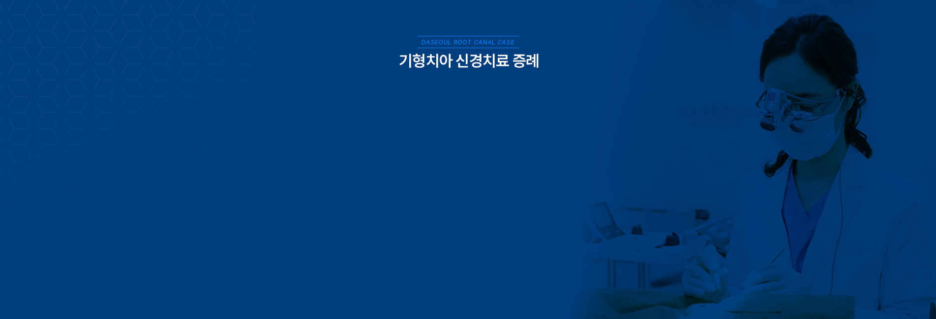 기형치아 신경치료 증례