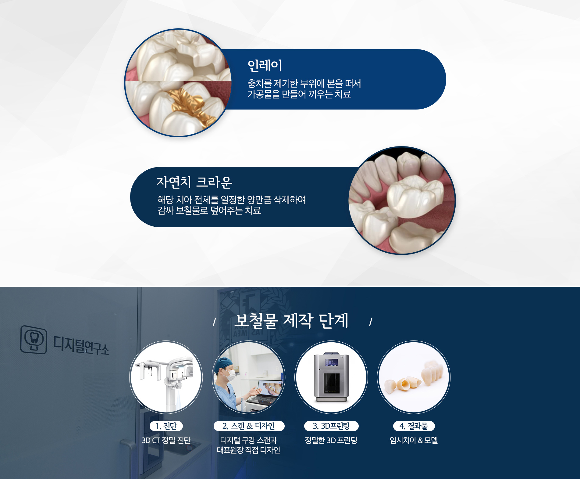 보철물 제작 단계