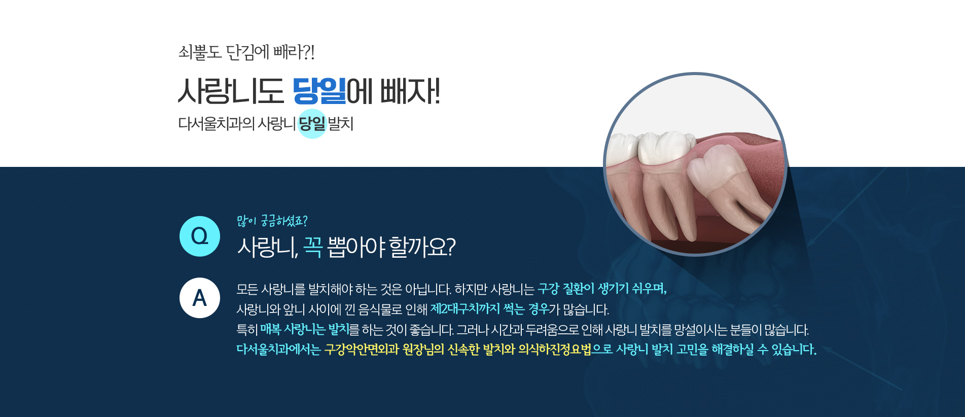 사랑니도 당일에 빼자!